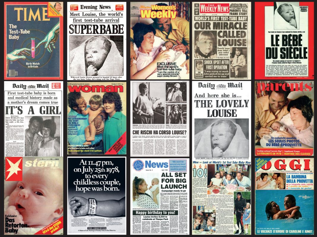 Το πρώτο μωρό που γεννήθηκε με εξωσωματική γονιμοποίηση - Δείτε σήμερα τη Λουίζ Μπράουν