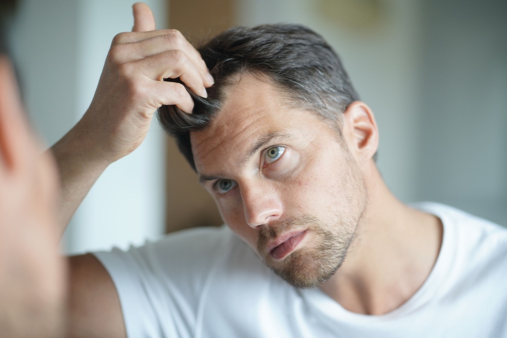 Healthstories-Πως βιώνουν άνδρες και γυναίκες την απώλεια των μαλλιών τους