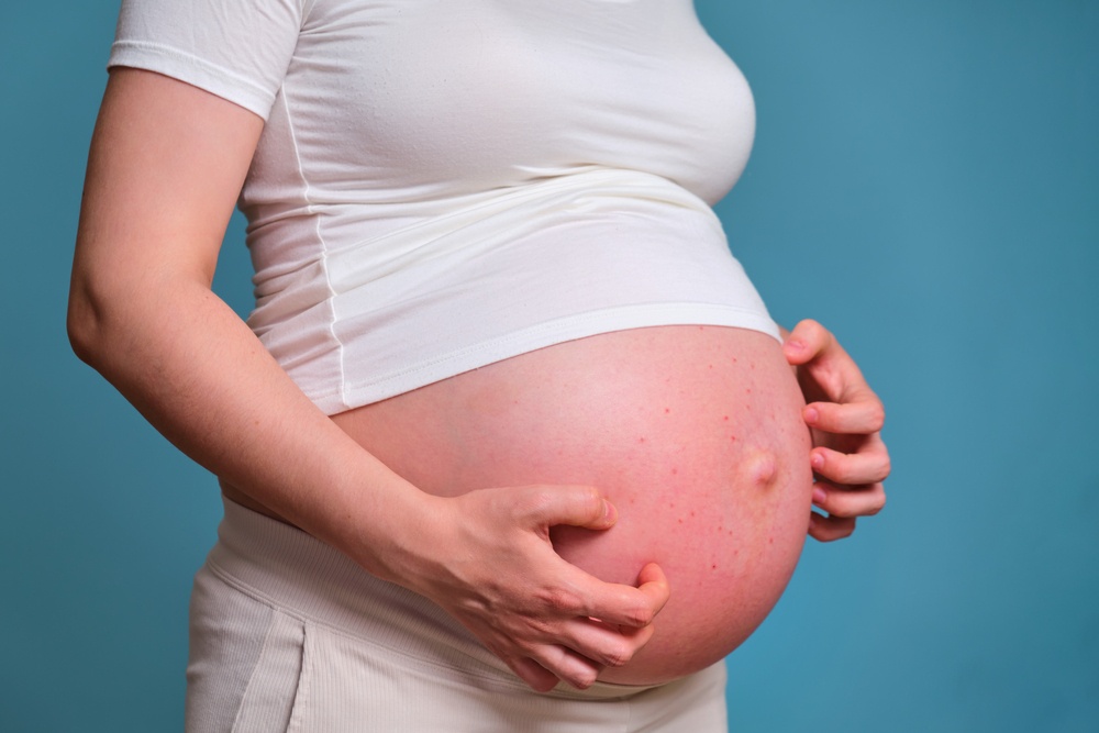 Healthstories Οι 7 δερματοπάθειες της εγκυμοσύνης Δεν είναι όλες ακίνδυνες