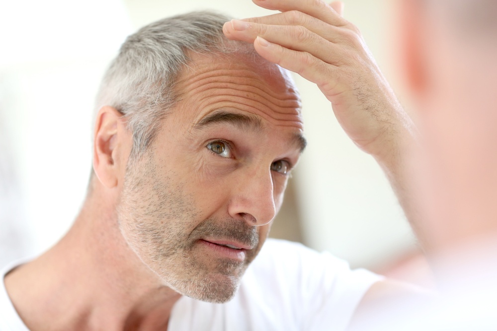 Γιατρός της Mayo Clinic αποκαλύπτει τις αιτίες που οι άνδρες χάνουν τα μαλλιά τους
