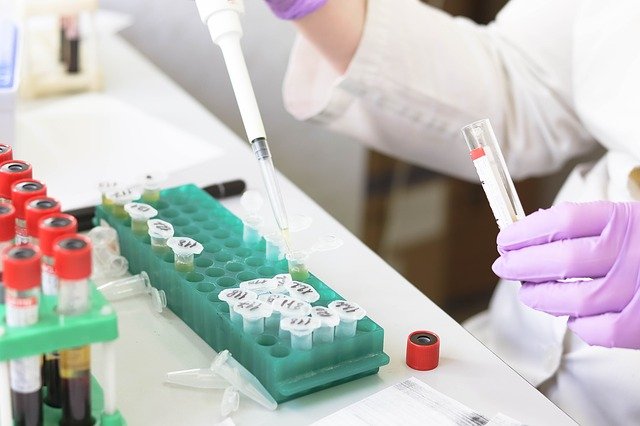 Πρώτος θάνατος από τον ιό Lassa στη Βρετανία - Χαρακτηρίζεται δυνητική πανδημία