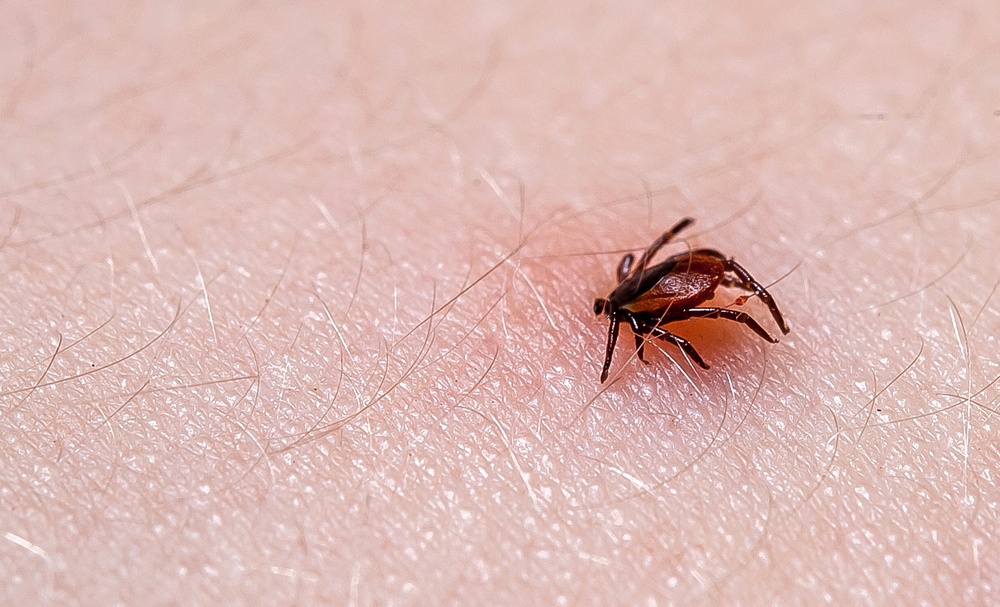 Εξαπλώνεται παγκοσμίως η νόσος Lyme από τα τσιμπούρια