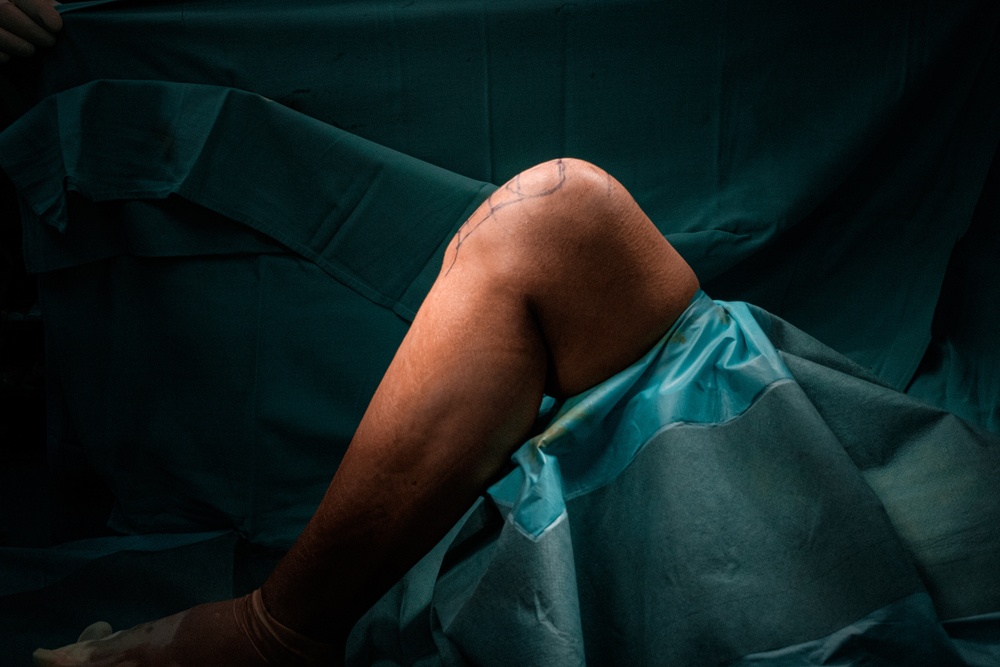 Healthstories Νέες μέθοδοι για την αρθροπλαστική γόνατος και ώμου