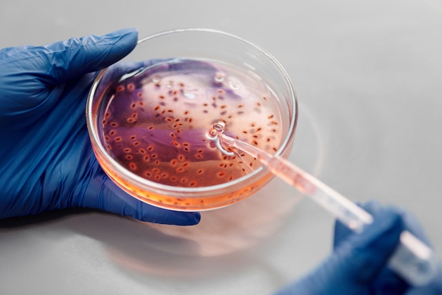 ΠΟΥ: Τα βακτήρια υπεύθυνα για συγκεκριμένες λοιμώξεις του αίματος