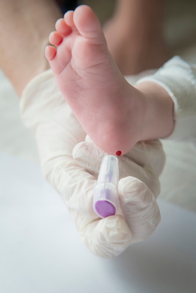 Σπάνιες παθήσεις: Ξεκινά γονιδιακή μελέτη σε 1000 μωρά