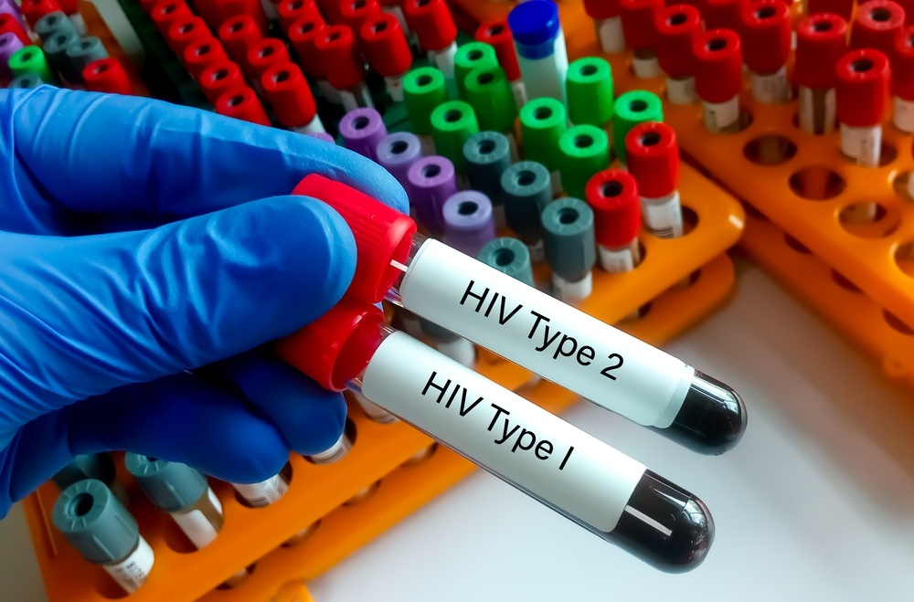 Healthstories Εθνικό Μητρώο Ασθενών με HIV και ηλεκτρονική συνταγογράφηση των αντιρετροϊκών, με τροπολογία Πλεύρη