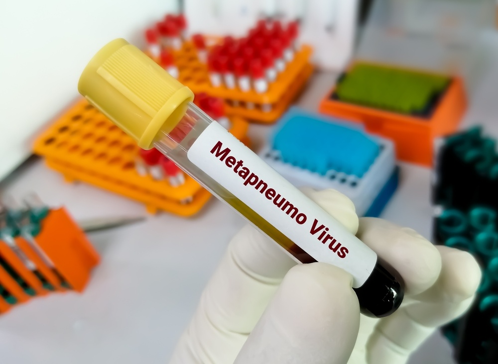 Healthstories Ο ανθρώπινος μεταπνευμοϊός - HMPV, γεμίζει τις ΜΕΘ στις ΗΠΑ - Ο ελάχιστα γνωστός ιός