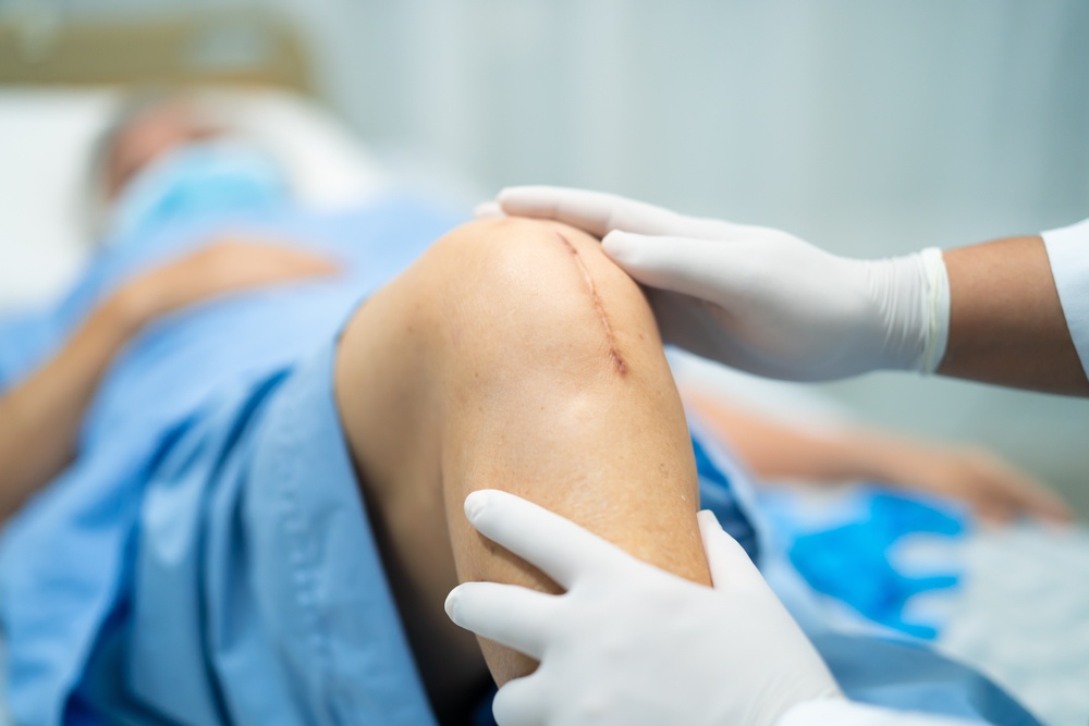 Healthstories Προηγμένες Τεχνικές στις αρθροπλαστικές ισχίου –γόνατος