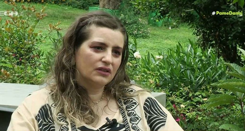 Μαρία Κίτσου: «Γέμισε το σώμα μου με ψωρίαση, έκανα ειδικές ενέσεις»