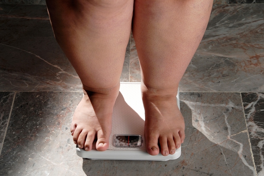 Healthstories Νέα εποχή στην αντιμετώπιση της σοβαρής παχυσαρκίας
