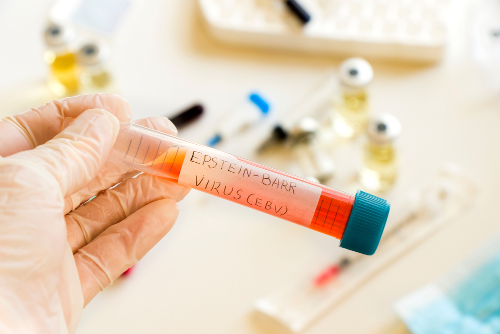 Εμβόλιο για τον ιό Epstein Barr αναπτύσσουν επιστήμονες
