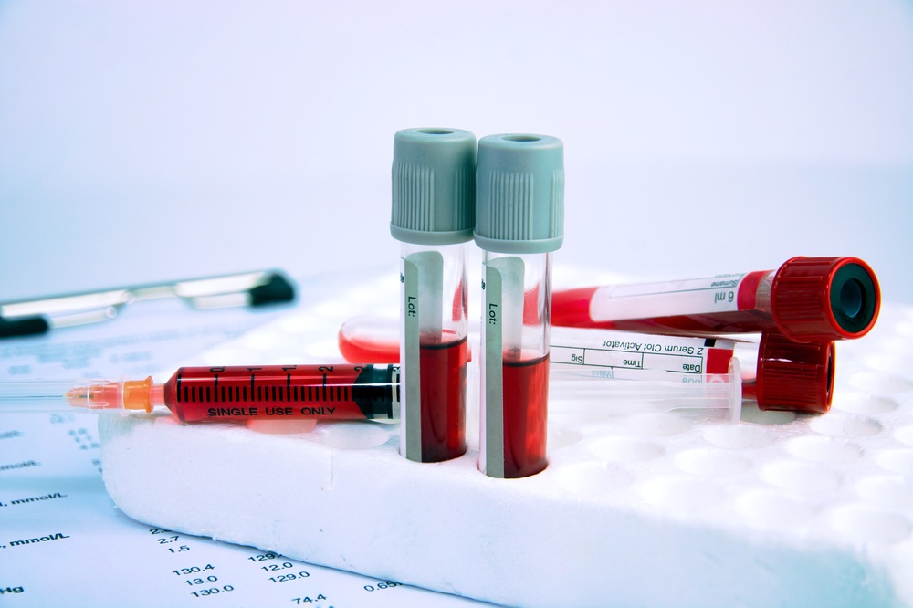Ο Γολγοθάς των ασθενών με αιματολογικά νοσήματα - Ελλείψεις φτηνών φαρμάκων και κόφτης σε σωτήριες εξετάσεις