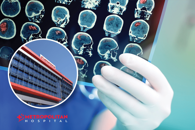 Healthstories Τεχνητή νοημοσύνη για αντιμετώπιση εγκεφαλικών επεισοδίων στο Metropolitan Hospital