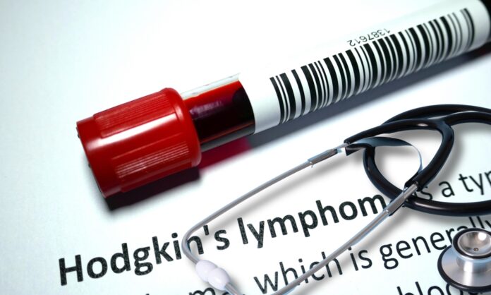 Επαναστατικές Θεραπείες για το Λέμφωμα Hodgkin: Μια Νέα Εποχή Ελπίδας ...