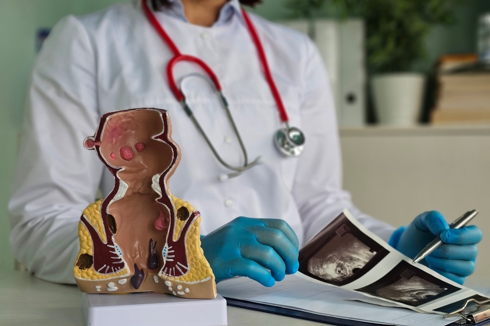 Rectal,Examination,And,Transrectal,Ultrasound.,Transabdominal,Ultrasonography,Detects,Ulcers,And astheneies paxeos enterou