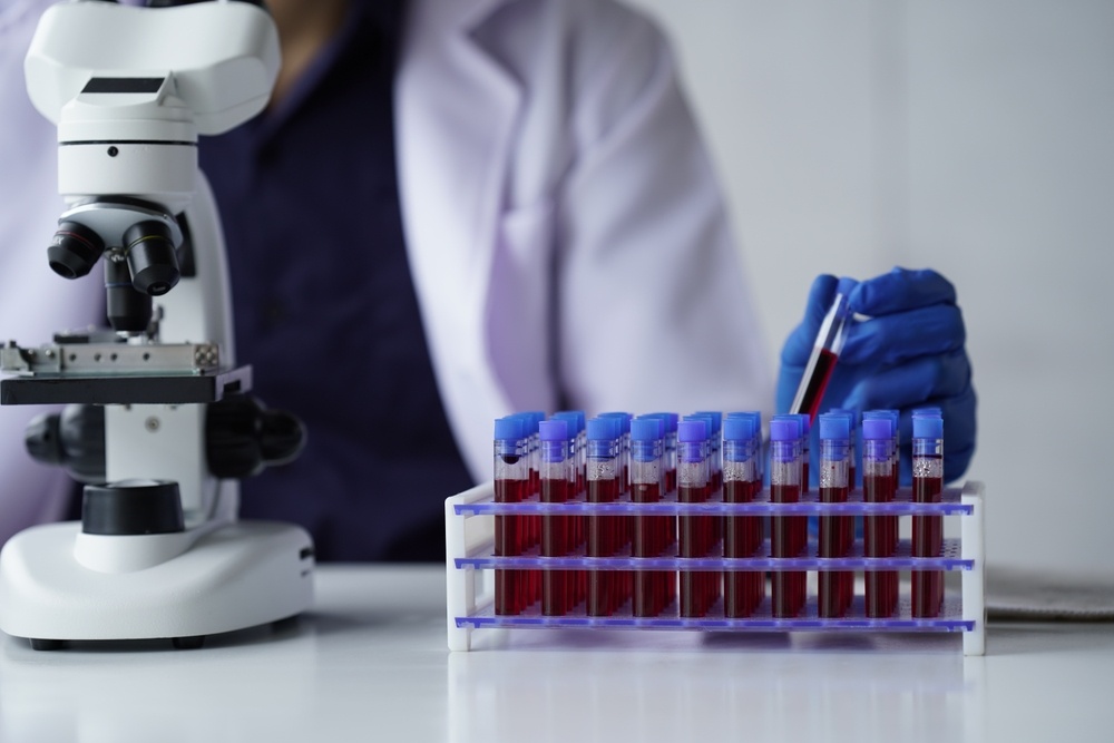 Lab,Worker,Preparing,Test,Blood,For,Detection,Of,Antibodies,And ergastiriakon